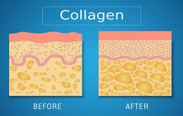 Collagen nâng đỡ các tế bào dưới da, giúp da căng đầy, giảm nếp nhăn