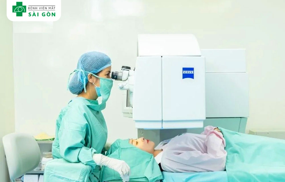 6 lầm tưởng về mổ mắt cận thị trong 2025.