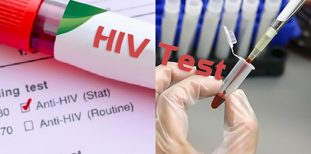 Chế độ báo cáo định kỳ hoạt động phòng, chống HIV/AIDS - Báo Thái ...