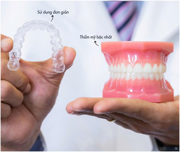 Giải bài toán niềng răng - Khi chuyên môn chính là yếu tố sống còn.