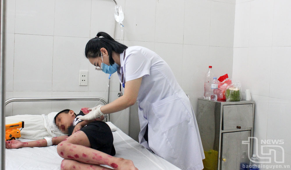 Bệnh nhân nhi 9 tuổi bị tay chân miệng được điều trị tại Bệnh viện Gang Thép.