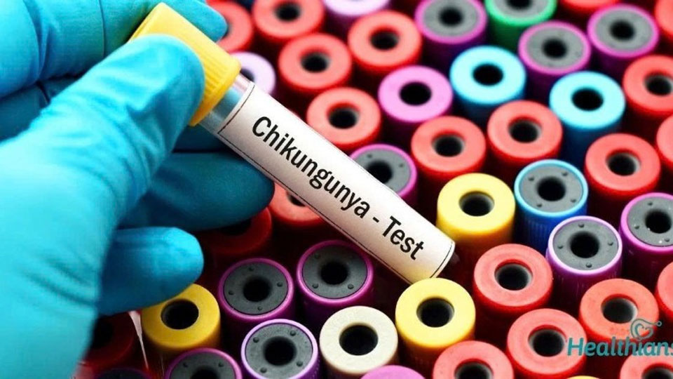 Đợt bùng phát virus Chikungunya đã bắt đầu từ đầu năm nay.