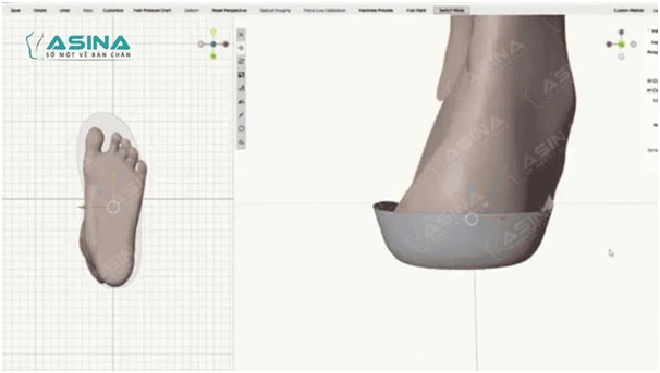 Video lót giày chỉnh hình 3D ASINA