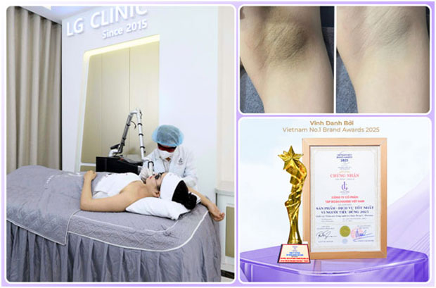 Công nghệ trị thâm Deep L-Picosure giúp vùng da dưới cánh tay sáng mịn chỉ sau 1 liệu trình ngắn