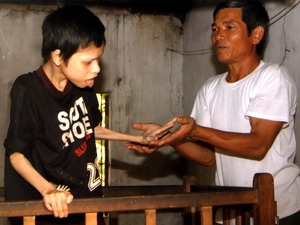 Hoàn thiện chế độ với nạn nhân chất độc da cam