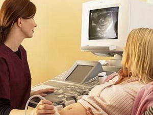 Xét nghiệm máu phát hiện sớm hội chứng Down