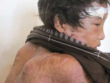 Nhiều tình tiết tăng nặng trong vụ án hành hạ cháu Hào Anh