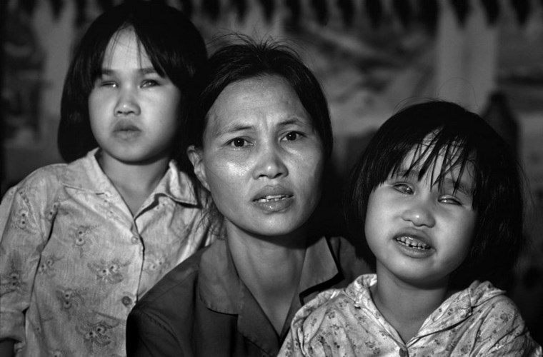 Khắc phục di họa của chiến tranh