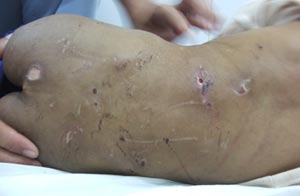 Cháu bé ba tuổi bị hành hạ như thú vật