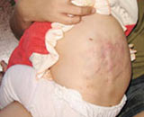 Bảo mẫu hành hạ bé gái 9 tháng tuổi lĩnh án tù